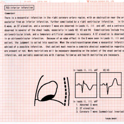 Fukuda Denshi CardiMax FX-8322 12 Kanallı EKG Cihazı