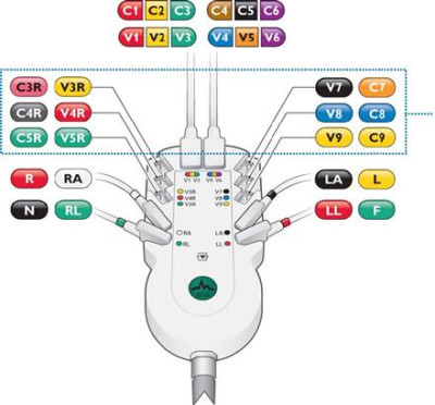 Philips Pagewriter TC30 12 Kanallı EKG Cihazı